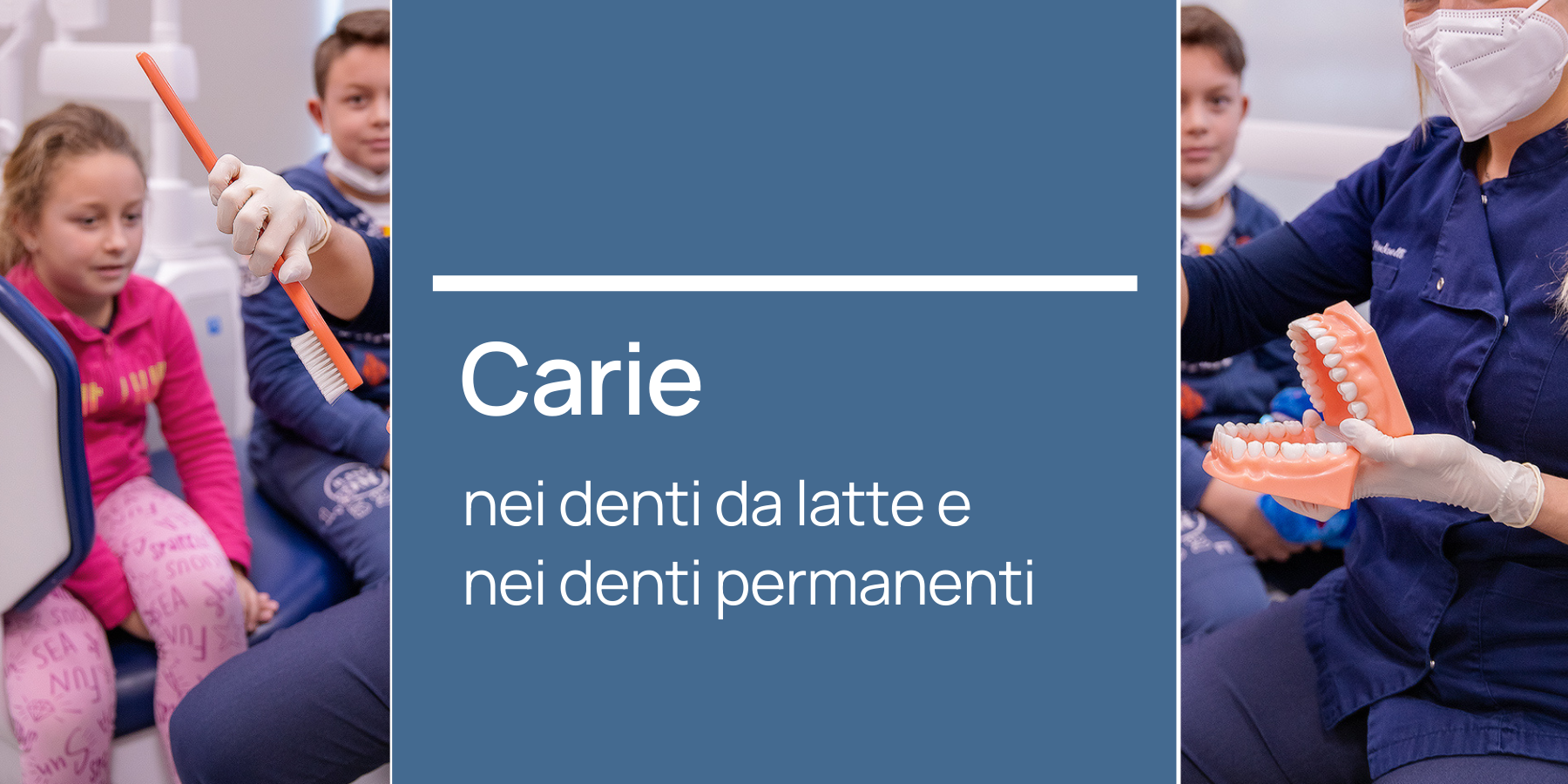 Carie denti