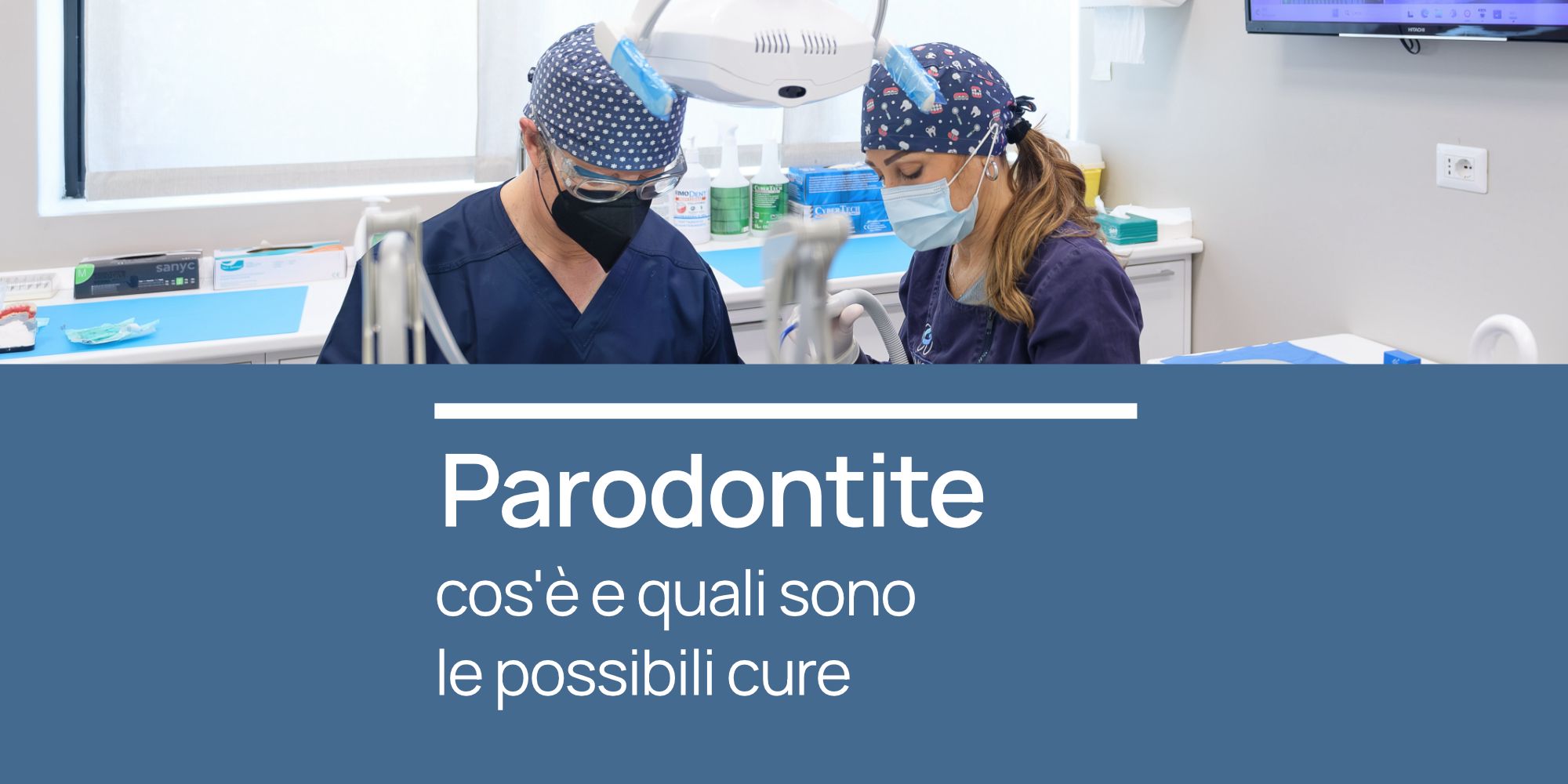 Parodontite cos'è